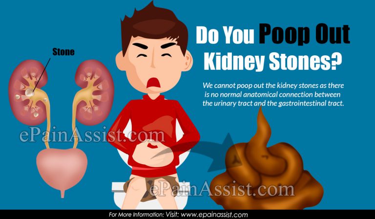 Do You Poop Out Kidney Stones?