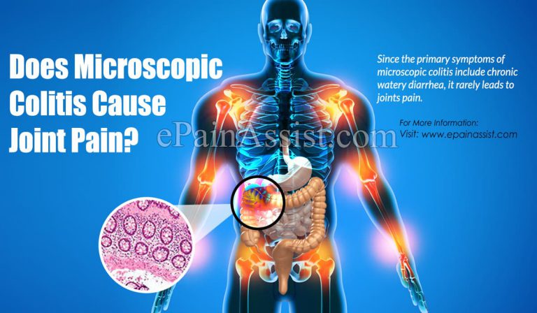 Does Microscopic Colitis Cause Joint Pain?