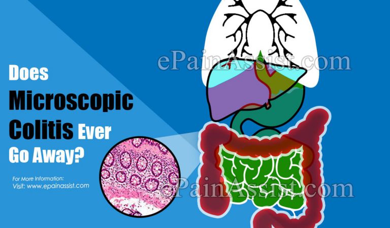 Does Microscopic Colitis Ever Go Away?