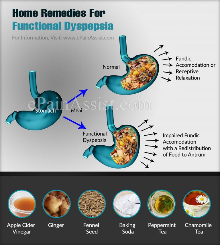 Home Remedies For Functional Dyspepsia & Can You Die From It?