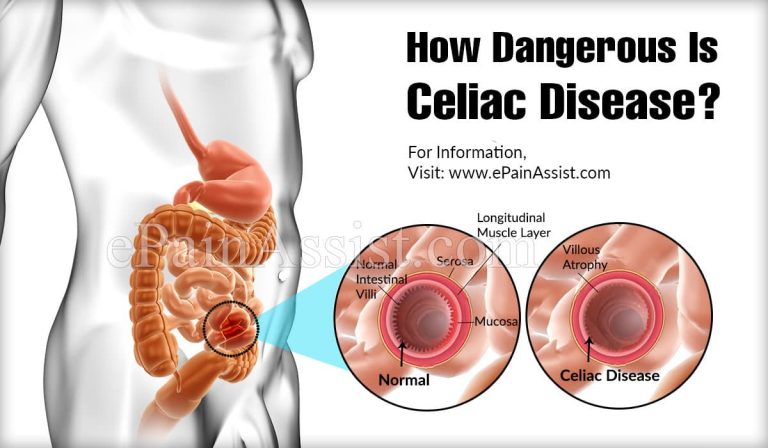 How Dangerous Is Celiac Disease & Is It Contagious?