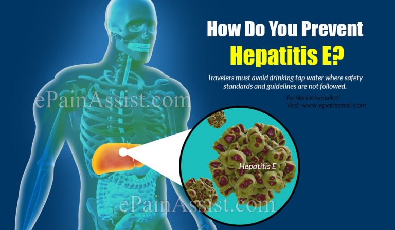 How Do You Prevent Hepatitis E?