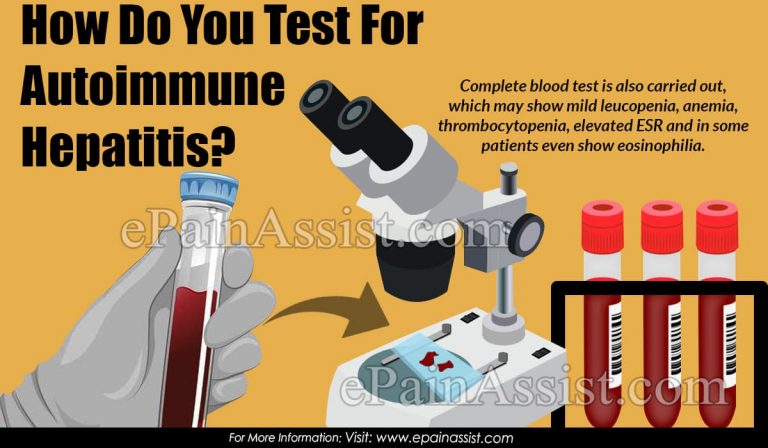 How Do You Test For Autoimmune Hepatitis?