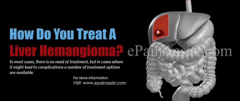 How Do You Treat A Liver Hemangioma?