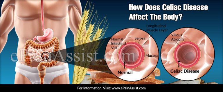 How Does Celiac Disease Affect The Body & What Triggers It?
