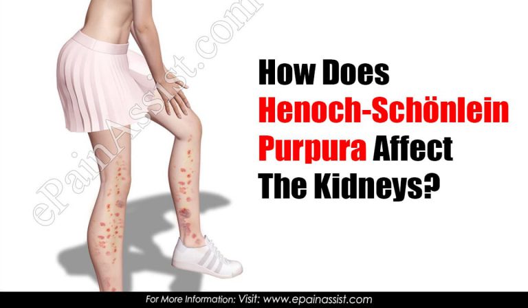 How Does Henoch-Schönlein Purpura Affect The Kidneys?