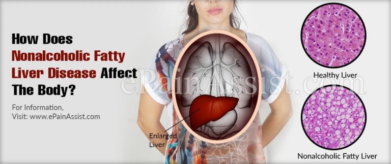 How Does Nonalcoholic Fatty Liver Disease Affect The Body & What Triggers It?
