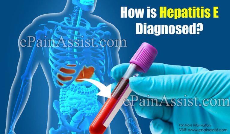 How is Hepatitis E Diagnosed?