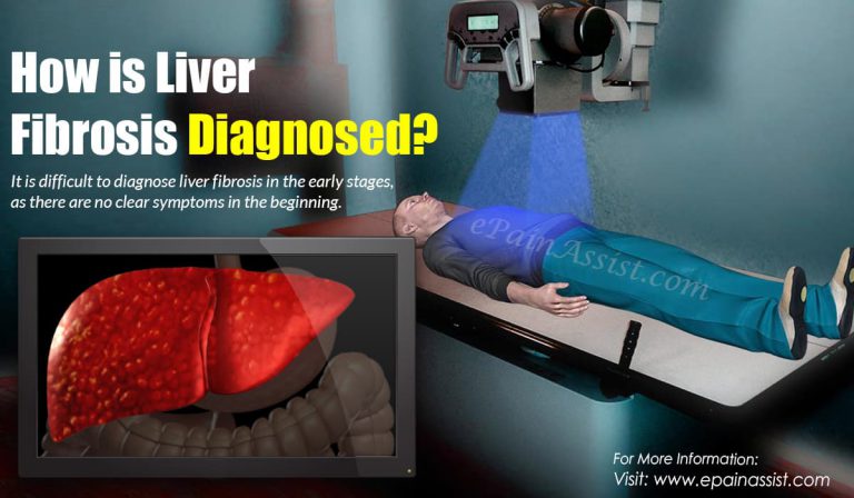 How is Liver Fibrosis Diagnosed?