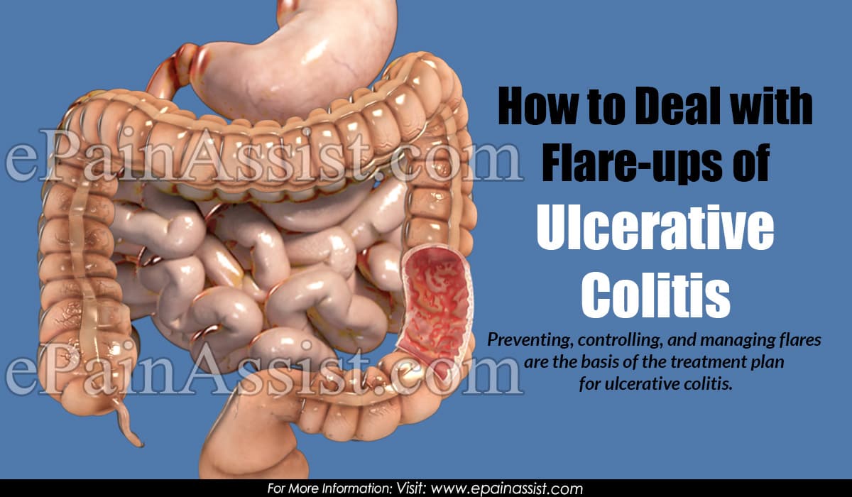 How to Deal with Flare-ups of Ulcerative Colitis