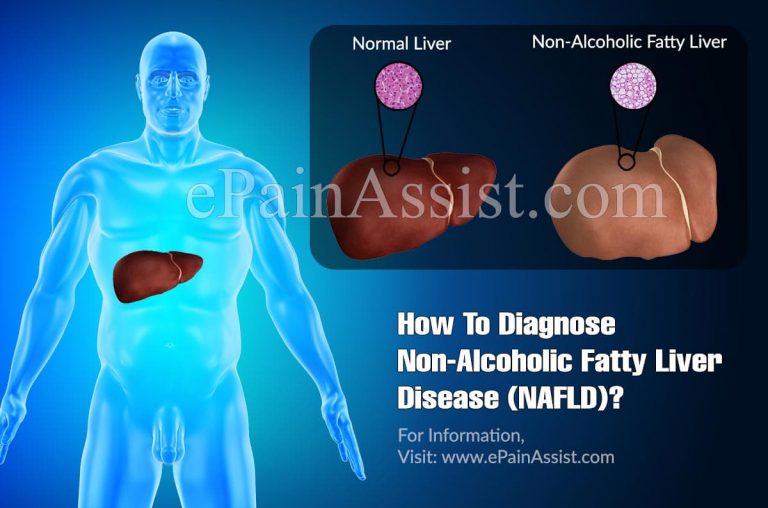 How To Diagnose Non-Alcoholic Fatty Liver Disease & What Is The Best Medicine For It?
