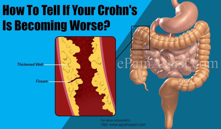 How To Tell If Your Crohn’s Is Becoming Worse?