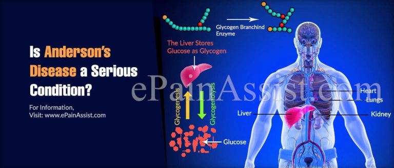 Is Anderson’s Disease a Serious Condition?