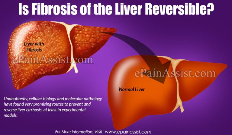Is Fibrosis of the Liver Reversible?