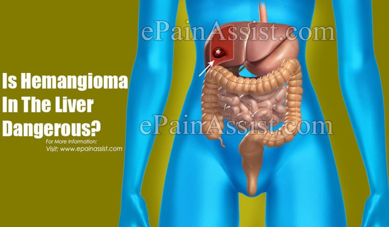 Is Hemangioma In The Liver Dangerous?
