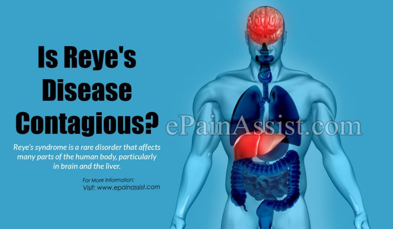 Is Reye’s Disease Contagious?
