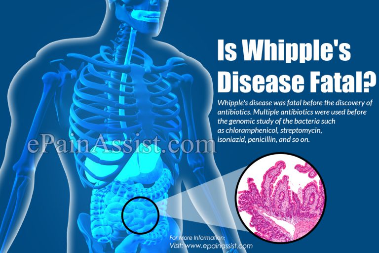 Is Whipple’s Disease Fatal?
