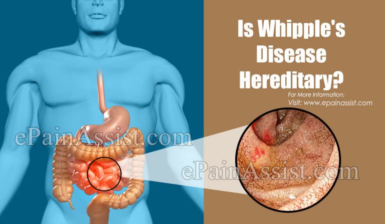 Is Whipple’s Disease Hereditary?
