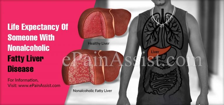 Life Expectancy Of Someone With Nonalcoholic Fatty Liver Disease