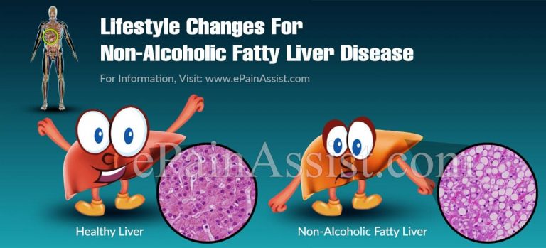 Lifestyle Changes For Non-Alcoholic Fatty Liver Disease