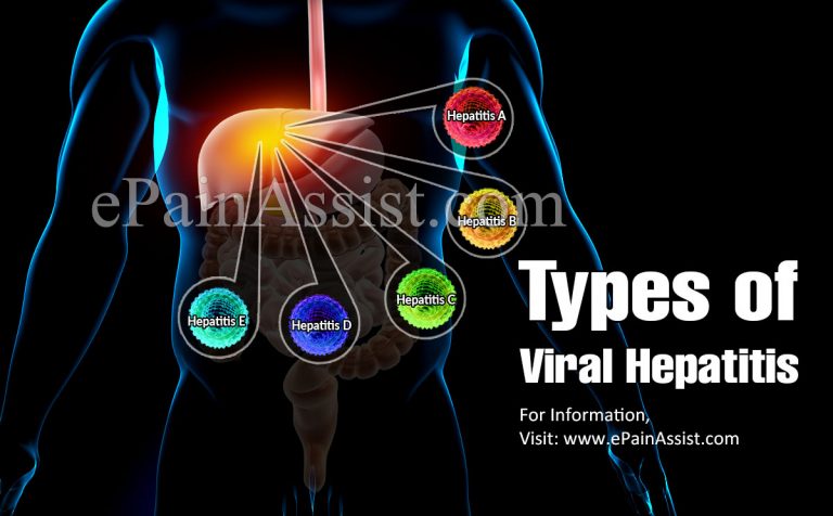 Viral Hepatitis and Hepatitis A: Outbreak, Causes, Symptoms, Treatments, Prevention