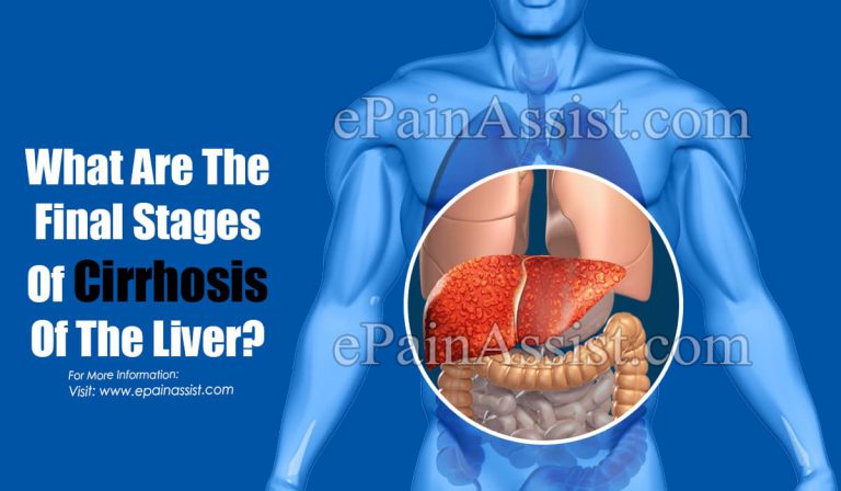 What Are The Final Stages Of Cirrhosis Of The Liver?