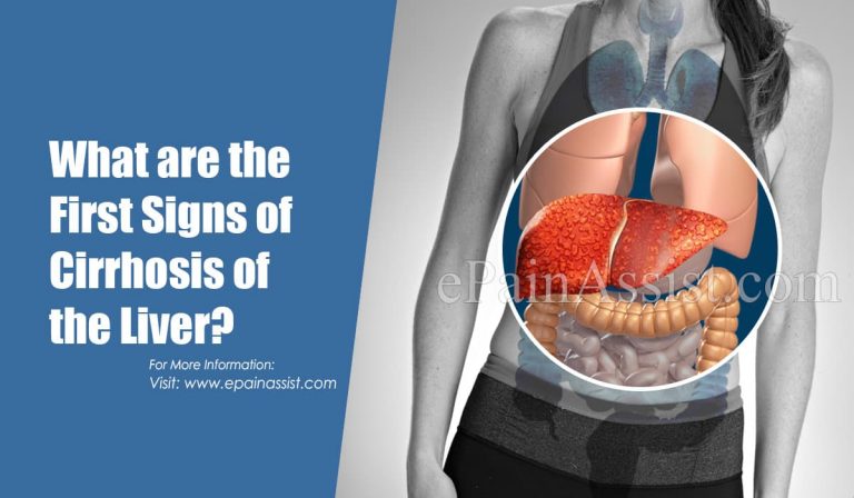What are the First Signs of Cirrhosis of the Liver?