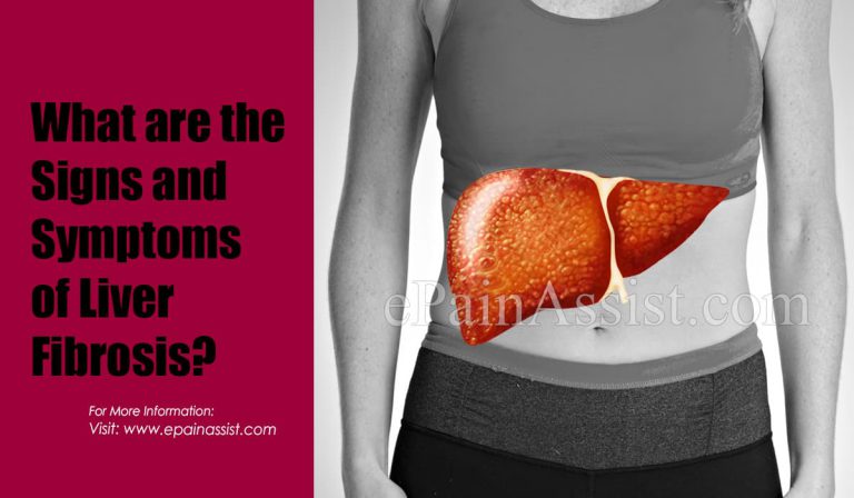 What are the Signs and Symptoms of Liver Fibrosis?
