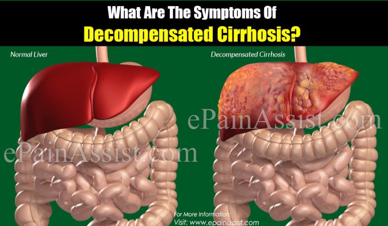 What Are The Symptoms Of Decompensated Cirrhosis?