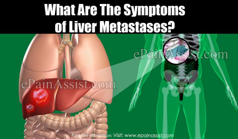 What Are The Symptoms of Liver Metastases?