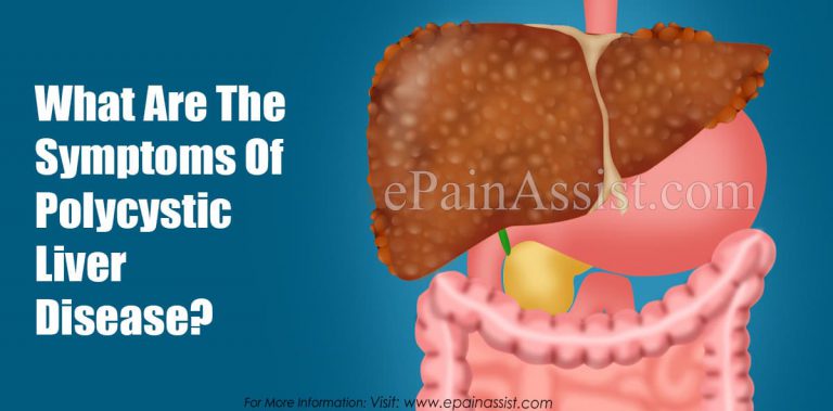 What Are The Symptoms Of Polycystic Liver Disease?