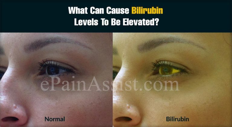 What Can Cause Bilirubin Levels To Be Elevated?