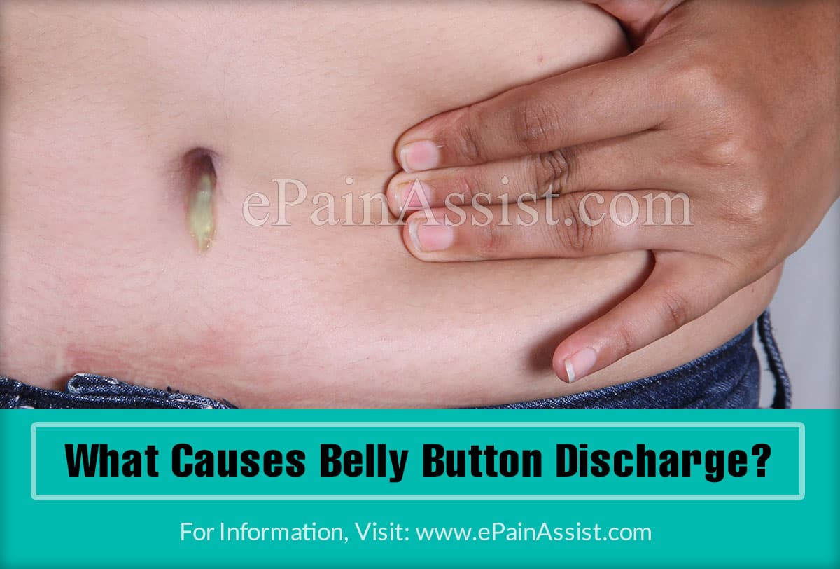 What Causes Belly Button Discharge?