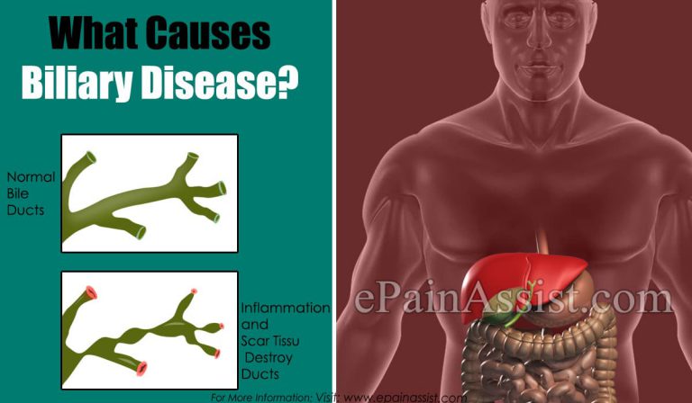 What Causes Biliary Disease?