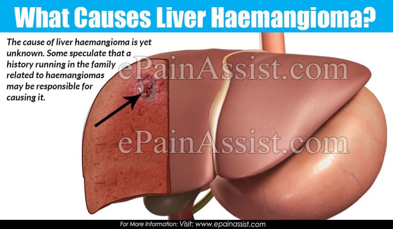 What Causes Liver Haemangioma?