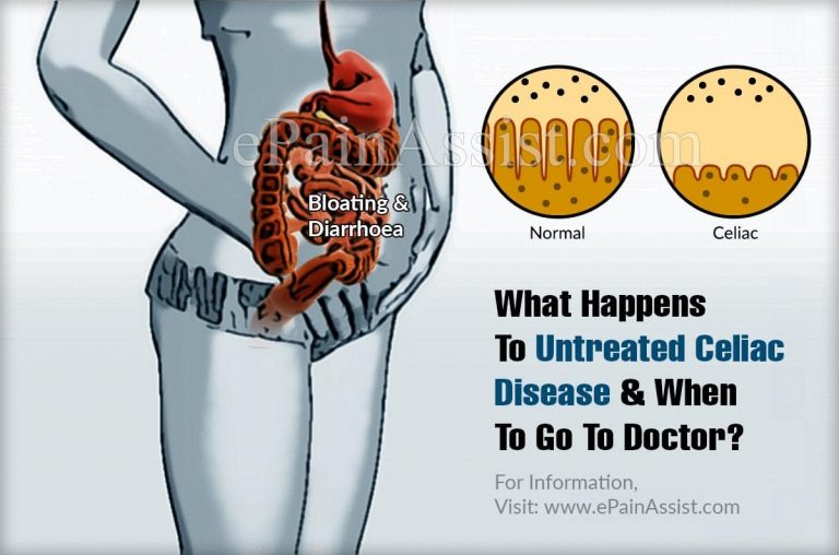 What Happens To Untreated Celiac Disease & When To Go To Doctor?