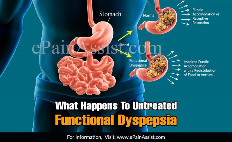 What Happens To Untreated Functional Dyspepsia & When To Go To Doctor?