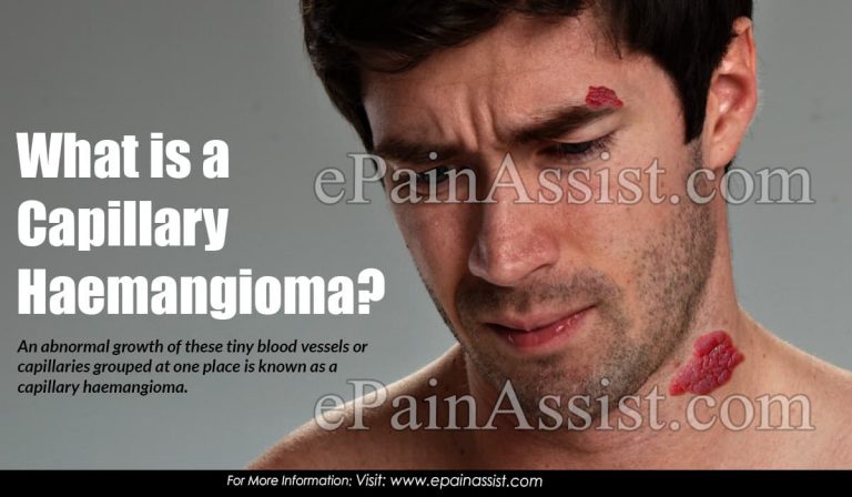What Is A Capillary Haemangioma?
