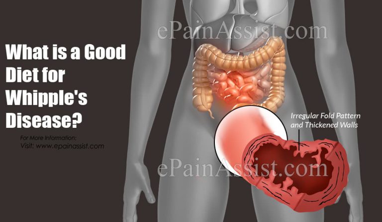 What Is A Good Diet For Whipple’s Disease?