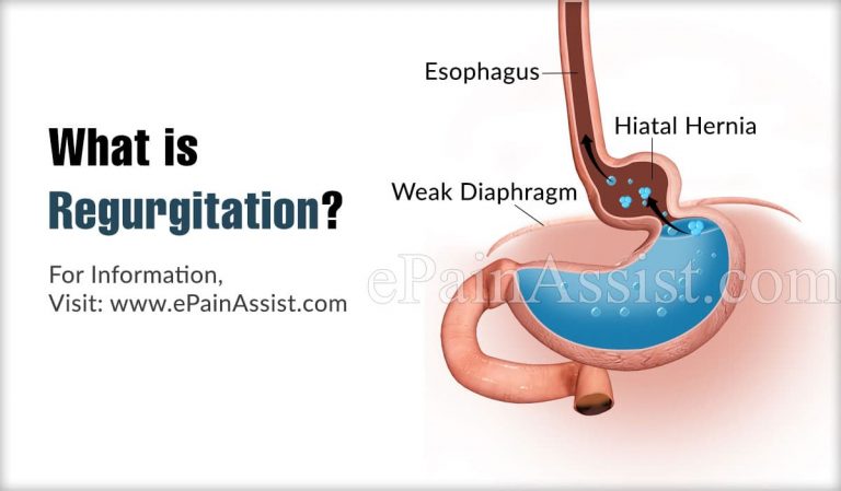 Regurgitation: Causes, Symptoms, Treatment, Diagnosis