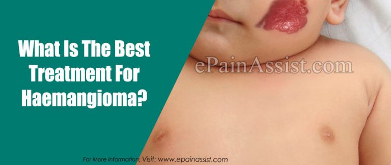 What Is The Best Treatment For Haemangioma?
