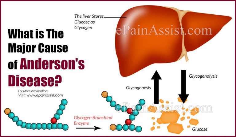 What is The Major Cause of Anderson’s Disease?
