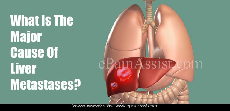 What Is The Major Cause Of Liver Metastases?