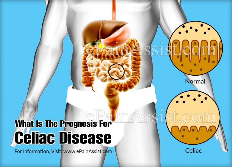What Is The Prognosis For Celiac Disease?