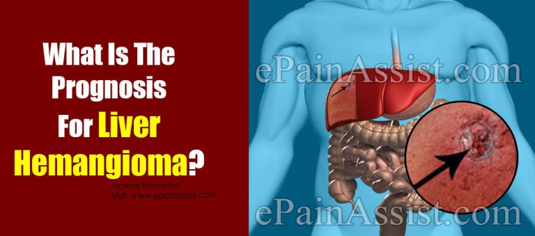 What Is The Prognosis For Liver Hemangioma?