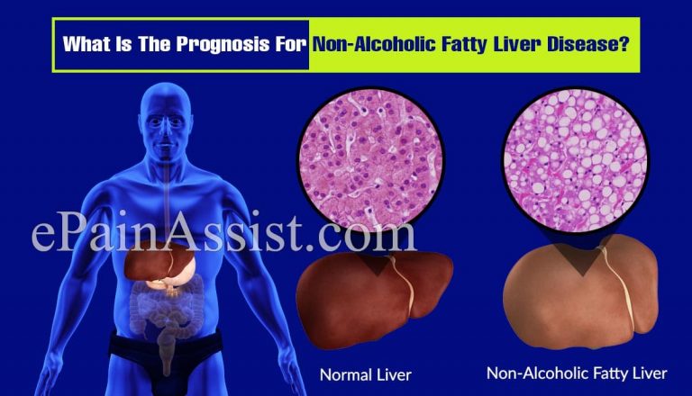What Is The Prognosis For Non-Alcoholic Fatty Liver Disease?