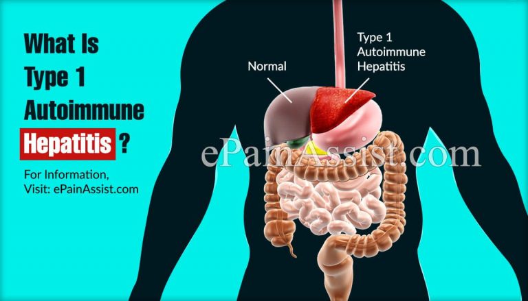 What Is Type 1 Autoimmune Hepatitis?