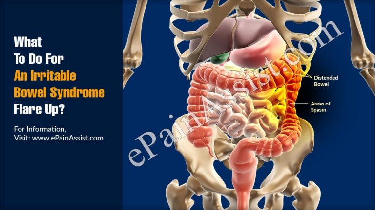 What to do for an Irritable Bowel Syndrome Flare Up?