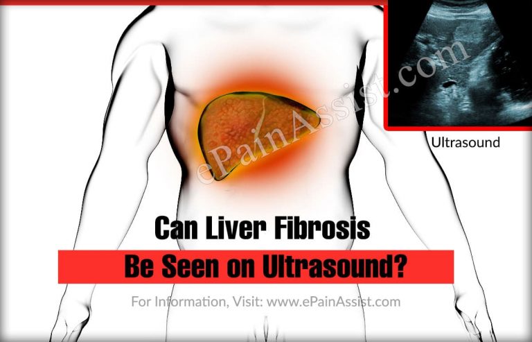 Can Liver Fibrosis be seen on Ultrasound?