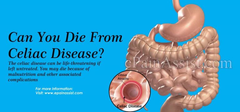 Can You Die From Celiac Disease & Is It A Disability?